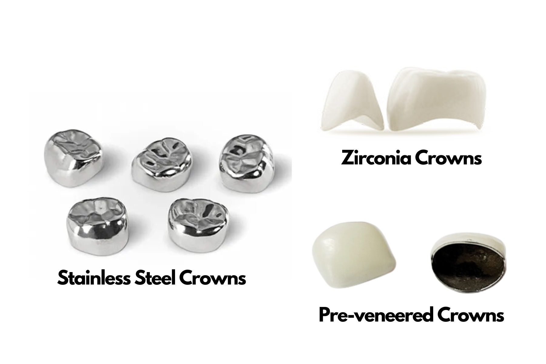 Multiple types of dental crowns