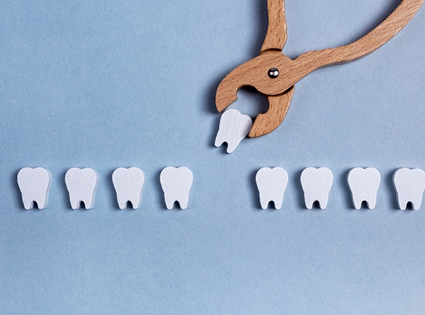 Toy teeth and pliers