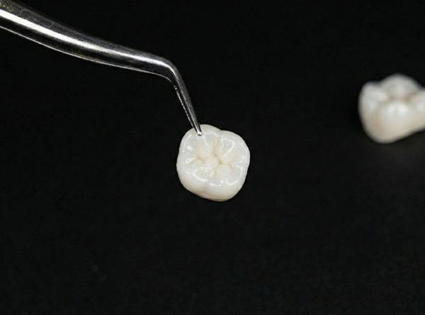 Dental tweezers holding a zirconia dental crown