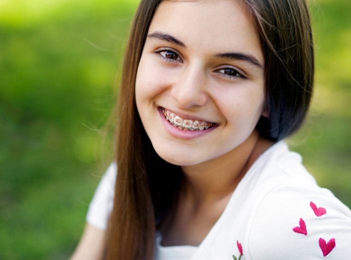 Young woman with braces smiling after dentistry for teens