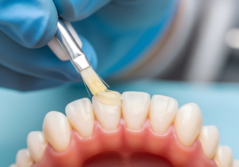 dentist applying fluoride to teeth